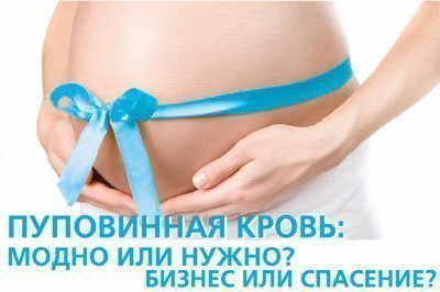 Пуповинная кровь: модно или нужно? Бизнес или спасение?
